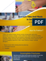 Fracture Tibia and Fibula