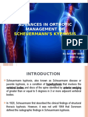 Boston Kyphosis Brace