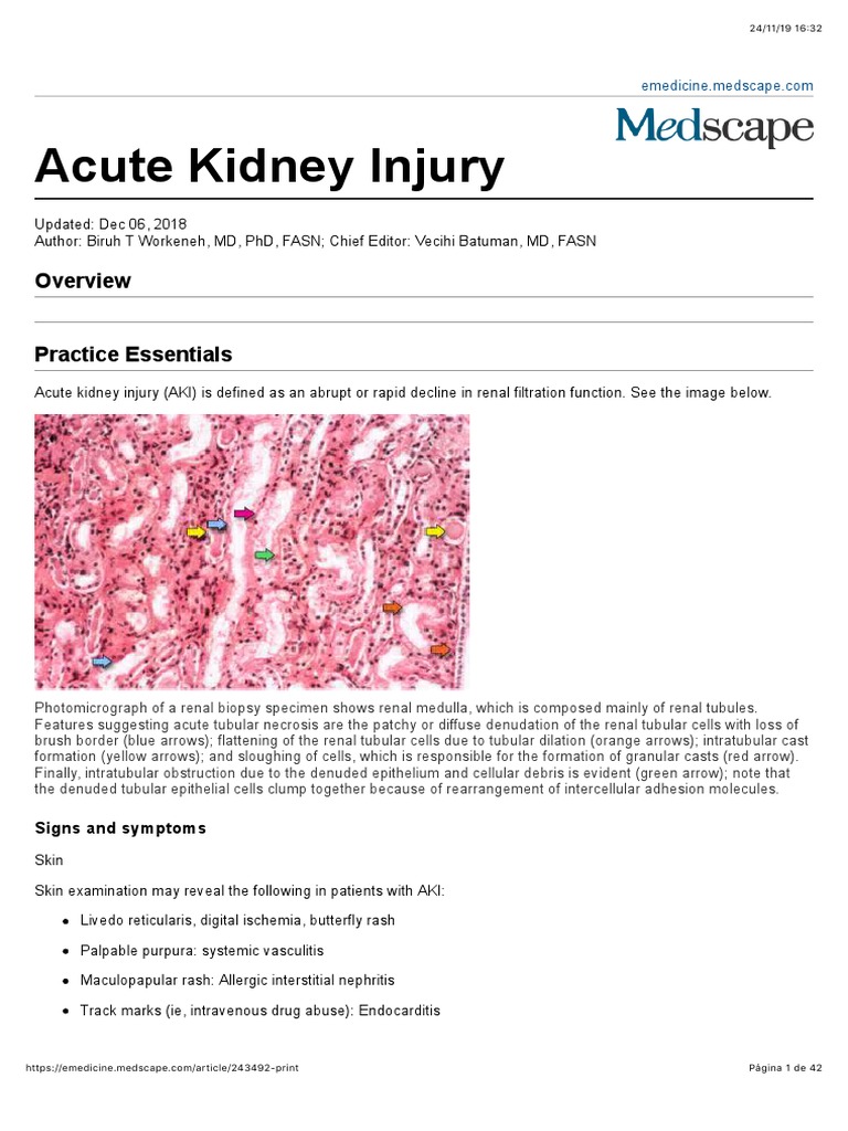 Acute Kidney Injury | PDF | Renal Function | Kidney