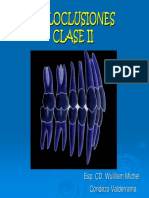 Maloclusiones Clase II