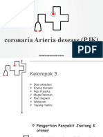 Coronary Artery Disease (CAD) Pain Relief