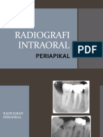 RADIOGRAFI Periapikal