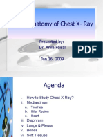 Chest X-Ray Updated