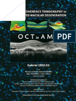 Optical Coherence Tomography in Age-Related Macular Degeneration