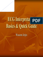Cute Interpretation of Ecg PDF