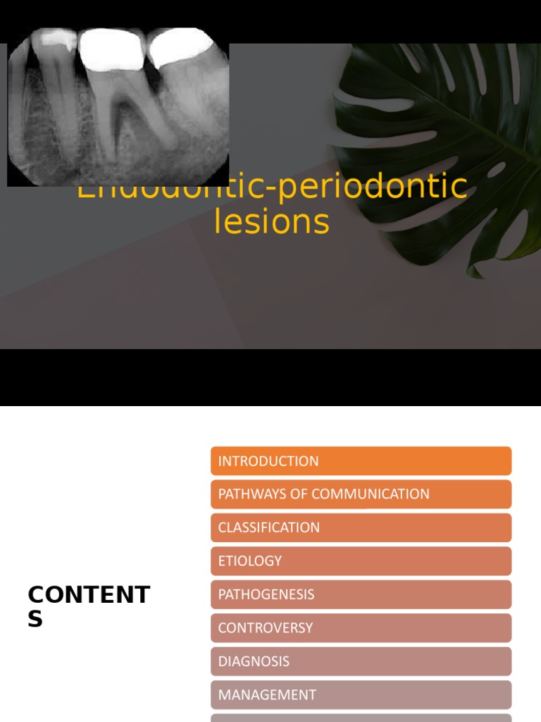 EndoPerio Lesions PDF Periodontology Human Tooth