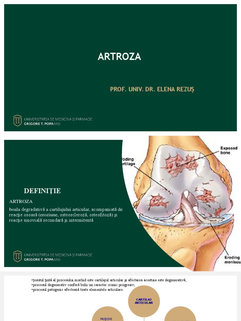 Artroza | PDF