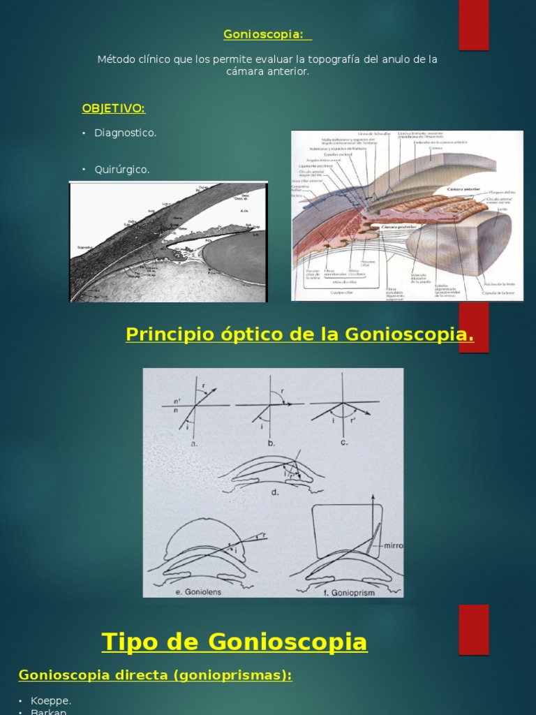 Gonios | PDF | Glaucoma | Córnea, image size:768x1024