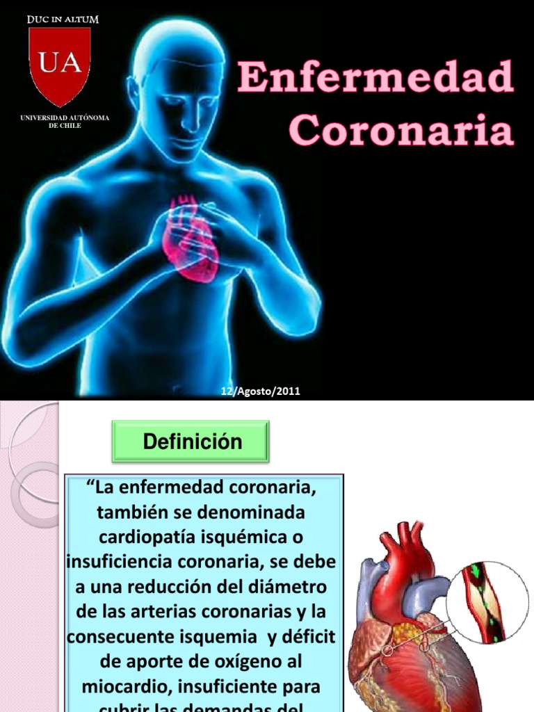 Definición y Tratamiento de Enfermedad Coronaria | PDF | Infarto de ...