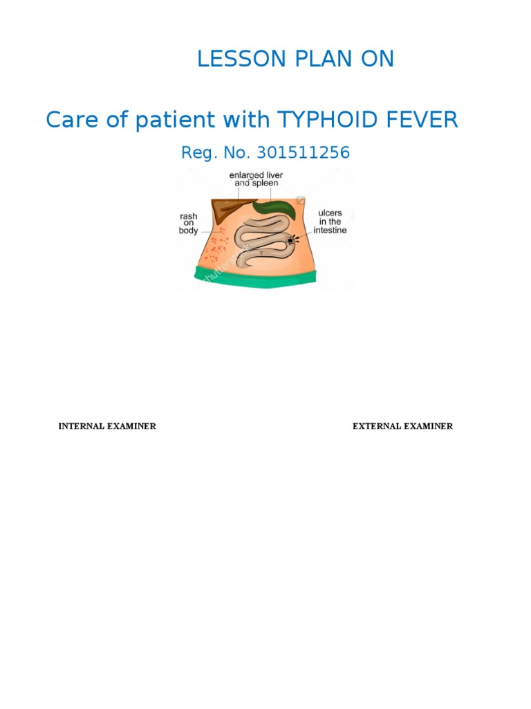 lesson-plan-on-typhoid-fever-pdf-multiple-drug-resistance-salmonella