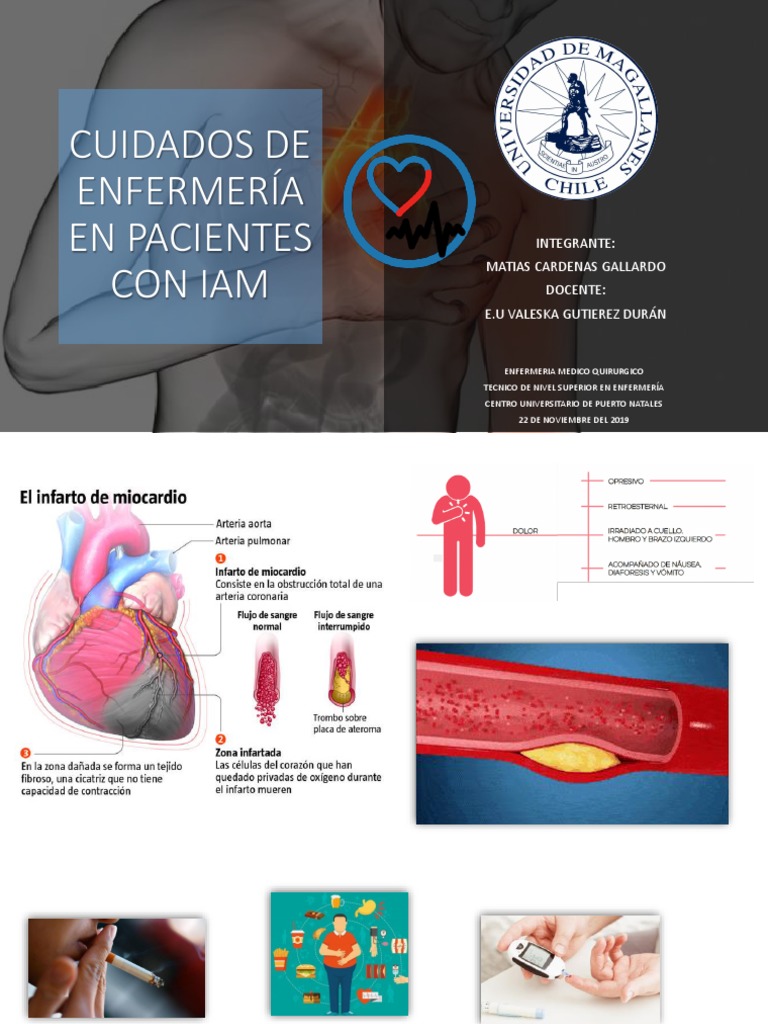 Cuidados de Infermeria en IAM | PDF | Hipertensión | Rtt