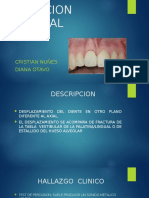 Luxacion Lateral Odontologica