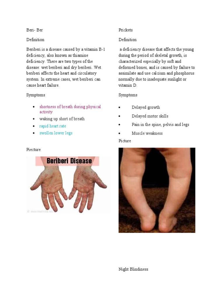 Beriberi Disease