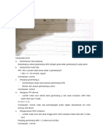 ECG Interpretasi