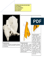 LP Temporal,Occipital.pdf