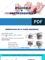 Onfalocele y Gatrosquisis