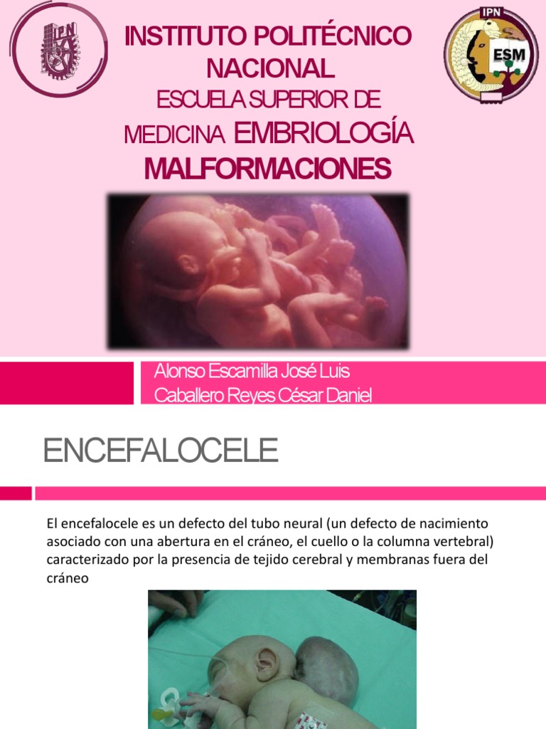 MALFORMACIONES | PDF | Pediatría | Desorden congenito
