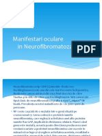 Manifestari Ocularein Neurofibromatoza Tip I