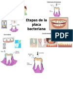 Etapas de La Placa Dental