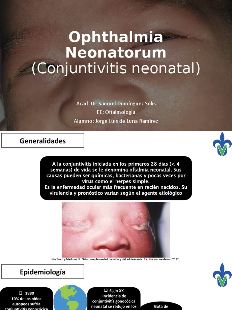 Conjuntivitis Neonatal: Causas y Tratamiento | PDF | Rtt ...