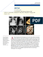 Giant Cardiac Hydatid Cyst: An Uncommon Cause of Cardiomegaly