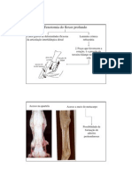 7-Tenotomia Do Flexor Profundo