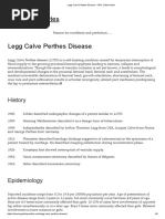 Legg Calve Perthes Disease - RP's Ortho Notes