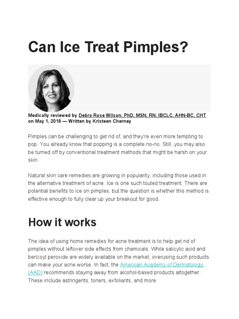 Can Ice Treat Pimples PDF Pimple Endocrine System