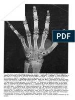 Greulich-Pyle Hand Wrist Atlas.pdf