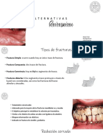 Alternativas quirúrgicas para fracturas maxilofaciales