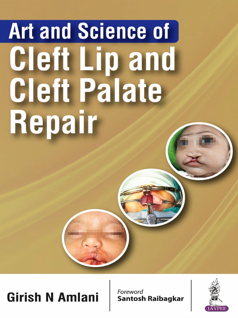 Art and Science of Cleft Lip and Cleft Palate Repair PDF | PDF ...