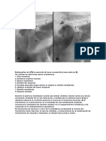 Radiografias de ATM en Posicion de Boca