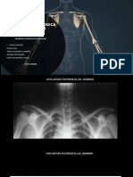 Anatomia Radiologica Extremidades Superiores (29