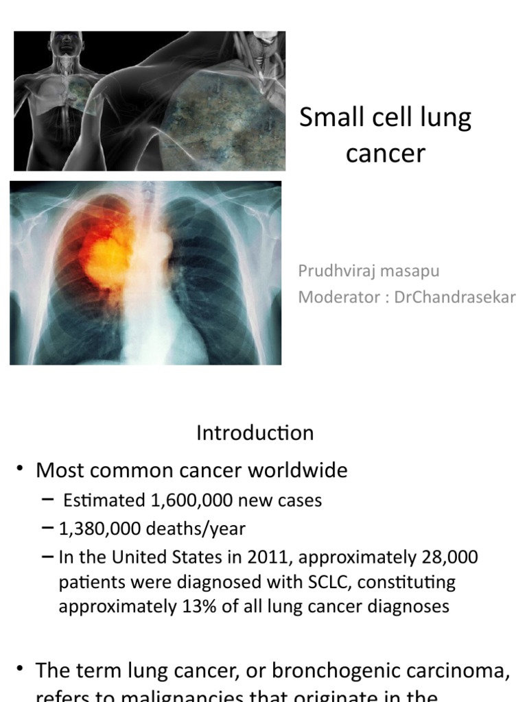 Small Cell Lung Cancer Overview | PDF | Lung Cancer | Radiation Therapy