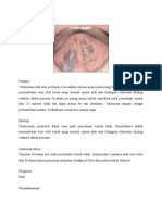 Lingual Varicositis