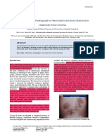 Abdominal Plain Radiograph in Neonatal Intestinal Obstruction