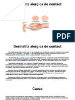 Dermatita Alergica de Contact