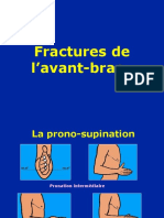 11 - Avant - Bras - Fractures