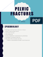 Pelvic Fractures