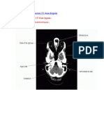 Anatomi CT Scan Kepala Potongan Axial Coronal Sagital