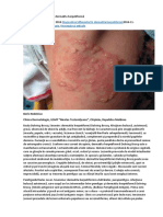 8 Diagnosticul Diferențial În Dermatita Herpetiformă