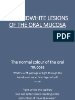 Red and White Lesions of The Oral Mucosa