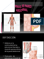 Hernias de Pared Abdominal M