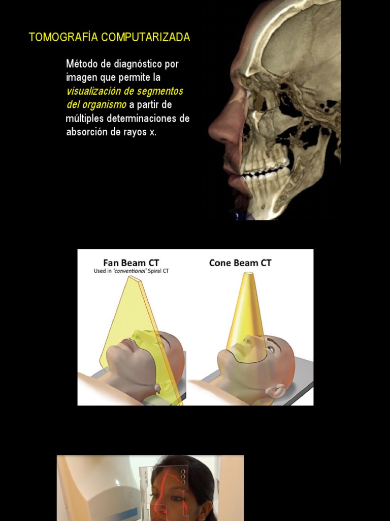 Tomografía Computarizada Cone Beam en Odontología | PDF