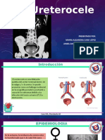 Ureterocele 1