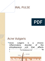 Acne PPT Azithral Pulse