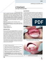 Mucous Membrane Pemphigoid: 10.5005/jp-Journals-10037-1072