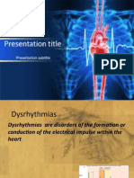 Dysarythmias