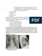 SOAL PULMONOLOGI SHANIA