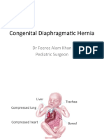 Congenital Diaphragmatic Hernia: DR Feeroz Alam Khan Pediatric Surgeon